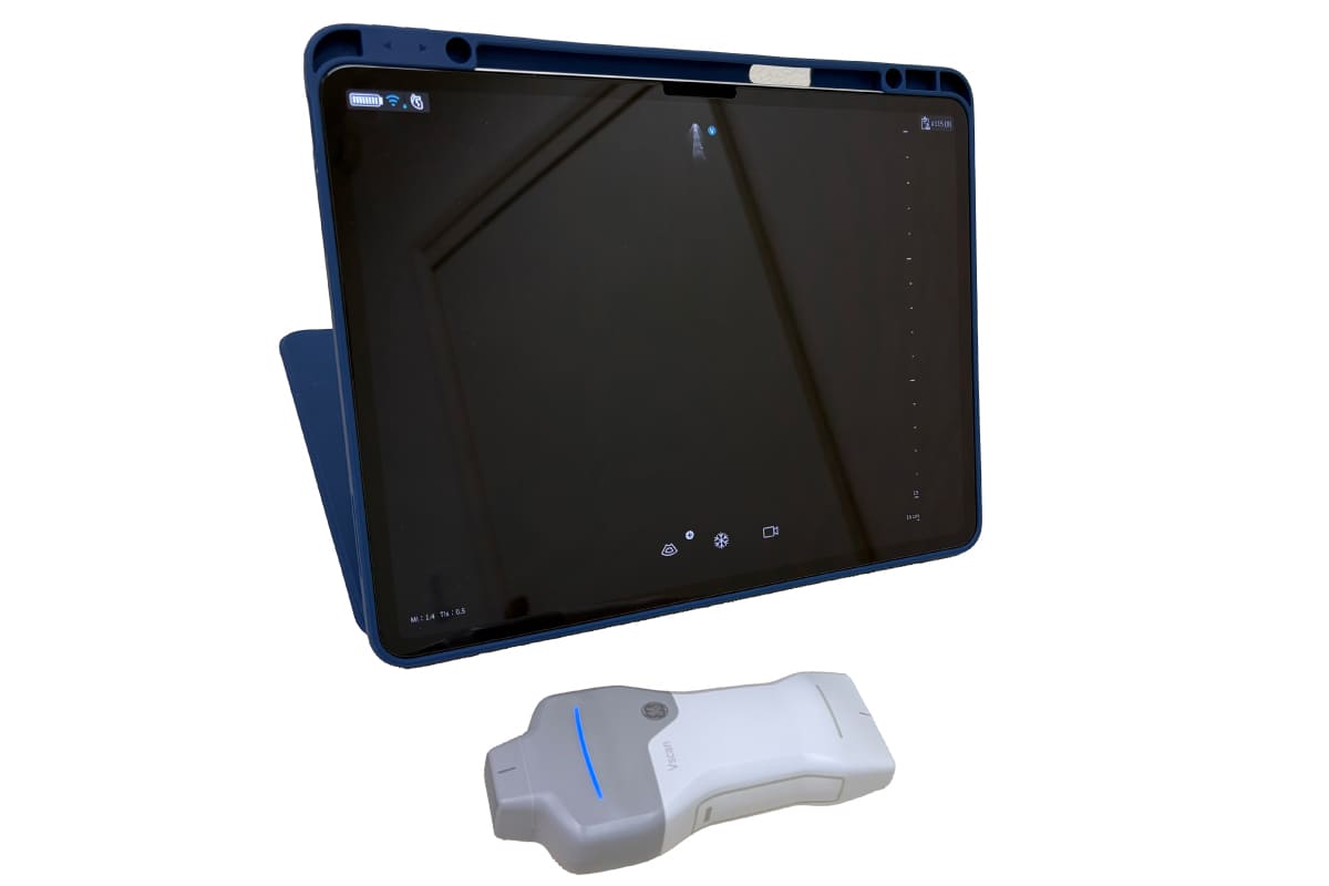 エコー検査装置（頸動脈、心臓など）